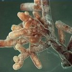 Mycorrhizae