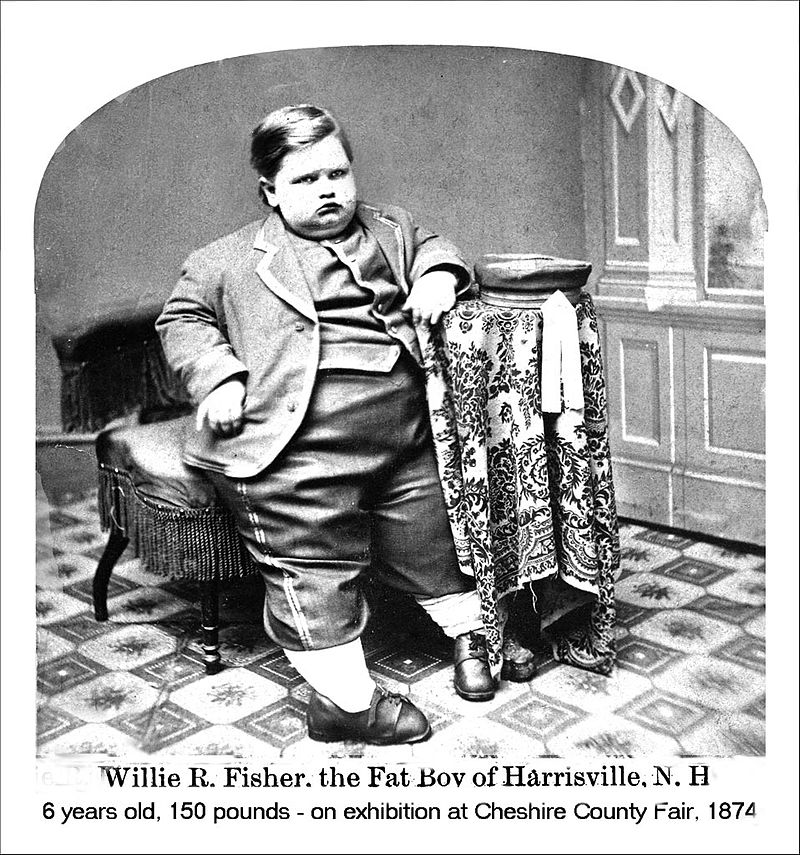 Obese
